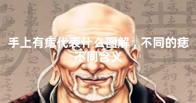 手上有痣代表什么图解,不同的痣不同含义